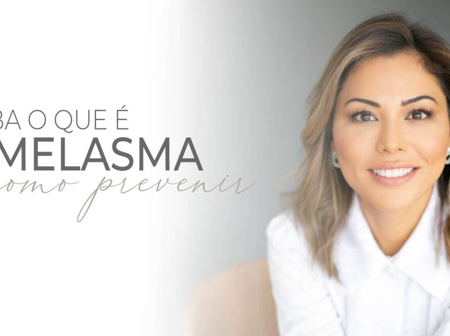 Melasma: como lidar com o problema?