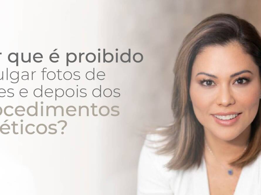 Por que não podemos postar fotos de antes e depois?